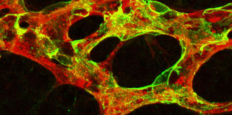 Transcriptional Profiling For Target Identification Pharmacogenomics