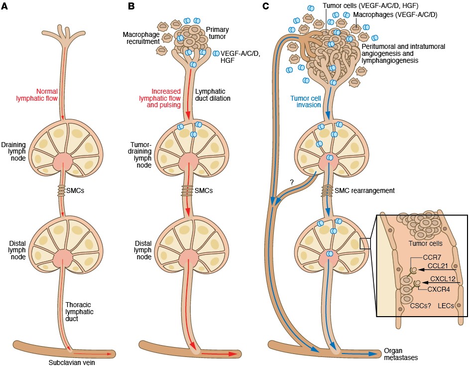 Tumor Lymphangiogenesis And Metastasis Pharmacogenomics Eth Zurich